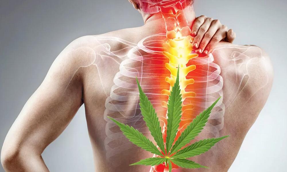 Medical Marijuana for Fast Back Pain Relief