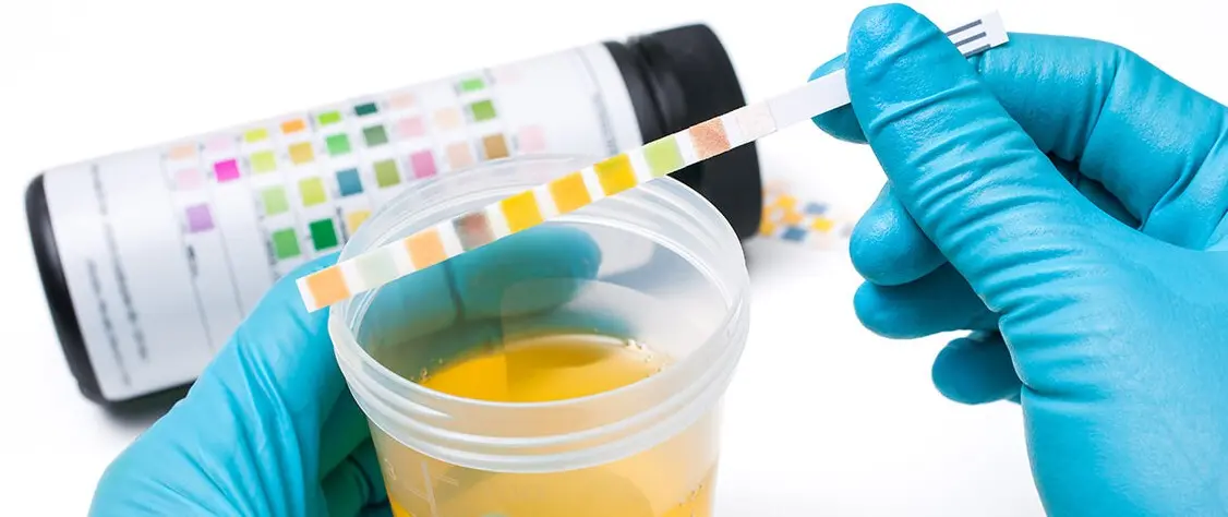 Complete Guide to Drug Tests & Screening